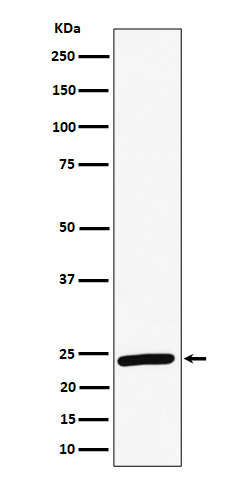 Western blot analysis of RAB8A expression in HeLa cell lysate.