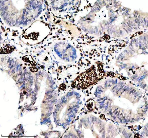 m02184 1 gypa primary antibodies ihc testing 1