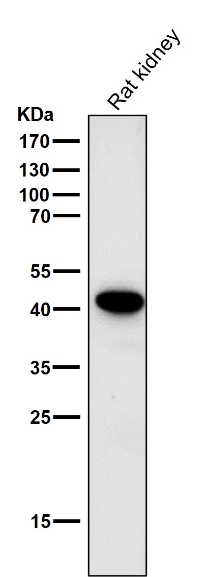 All lanes use the Antibody at 1:1K dilution for 1 hour at room temperature