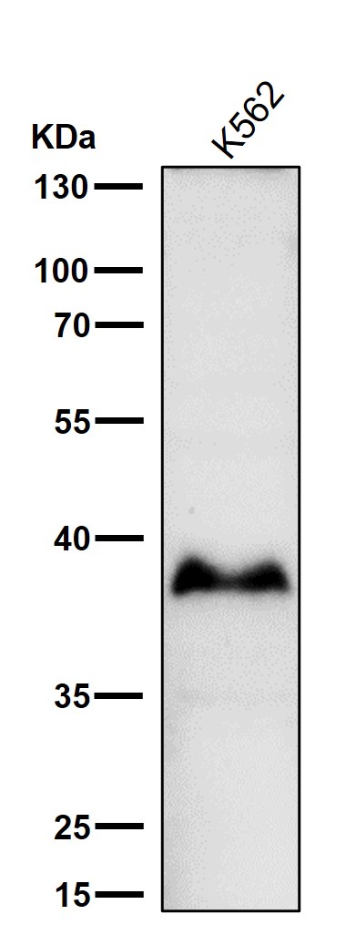 All lanes use the Antibody at 1:1K dilution for 1 hour at room temperature