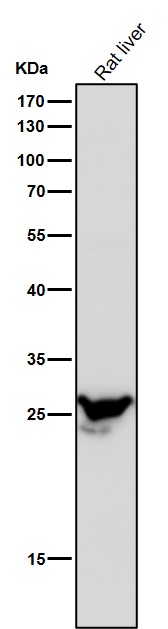 Anti-PSMB8 / LMP7 Monoclonal Antibody Anti-PSMB8 / LMP7 Monoclonal Antibody