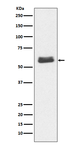 Western blot analysis of Caspase-10 expression in Jurkat cell lysate