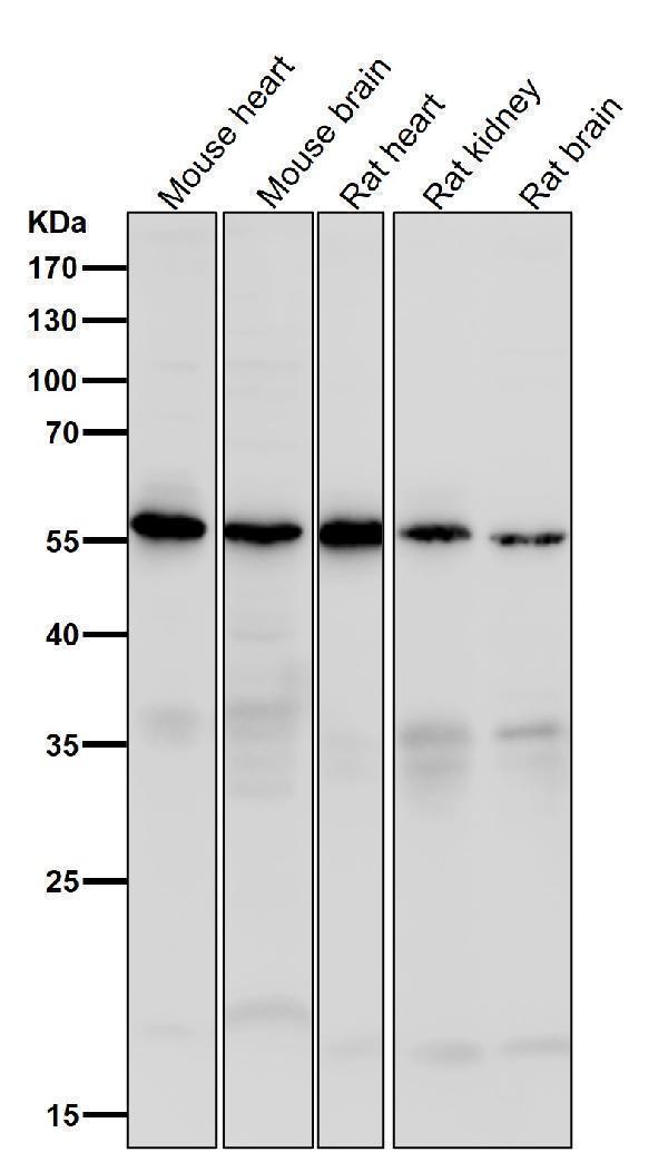 All lanes use the Antibody at 1:1K dilution for 1 hour at room temperature