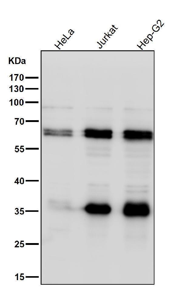 All lanes use the Antibody at 1:1K dilution for 1 hour at room temperature