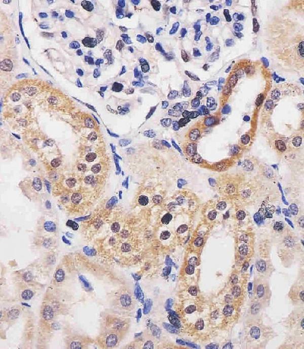 M02193-1 staining ADK in human kidney tissue sections by Immunohistochemistry (IHC-P -paraformaldehyde-fixed, paraffin-embedded sections)