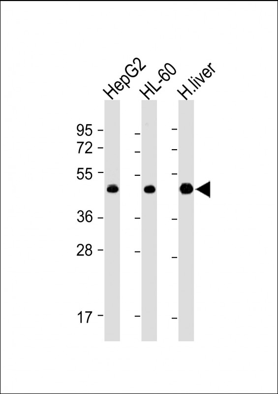 All lanes : Anti-ADK Antibody (N-term) at 1:4000 dilutionLane 1: HepG2 whole cell lysateLane 2: HL-60 whole cell lysateLane 3: Human liver lysateLysates/proteins at 20 µg per lane
