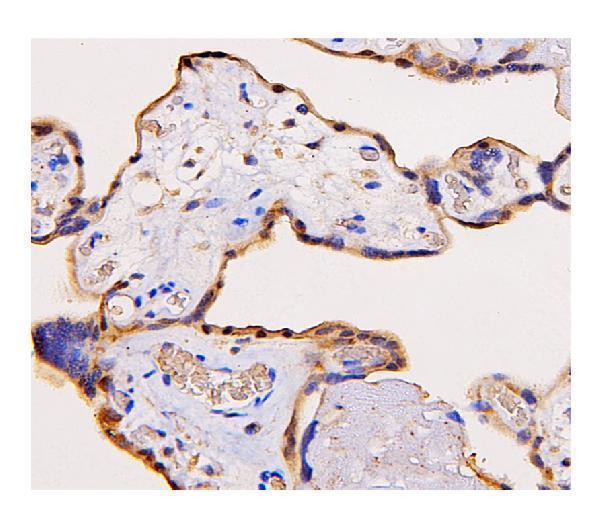  IHC analysis of ADK using anti-ADK antibody (M02193)