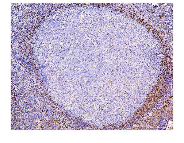  IHC analysis of ADK using anti-ADK antibody (M02193)