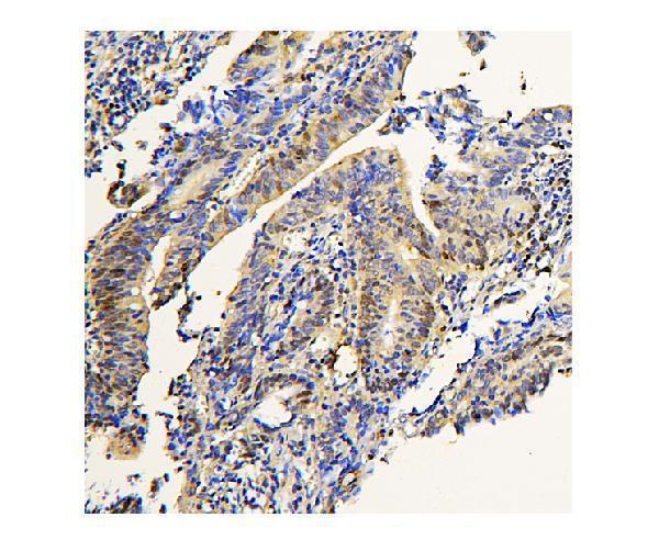 m02193 adk primary antibodies ihc testing 4