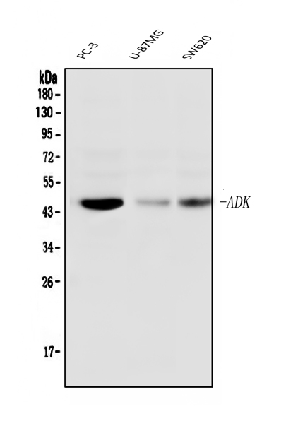  Western blot analysis of ADK using anti-ADK antibody (M02193)