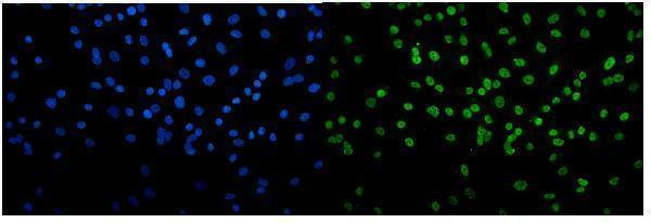 m02197 tkt primary antibodies if testing 11