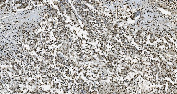 m02197 tkt primary antibodies ihc testing 10