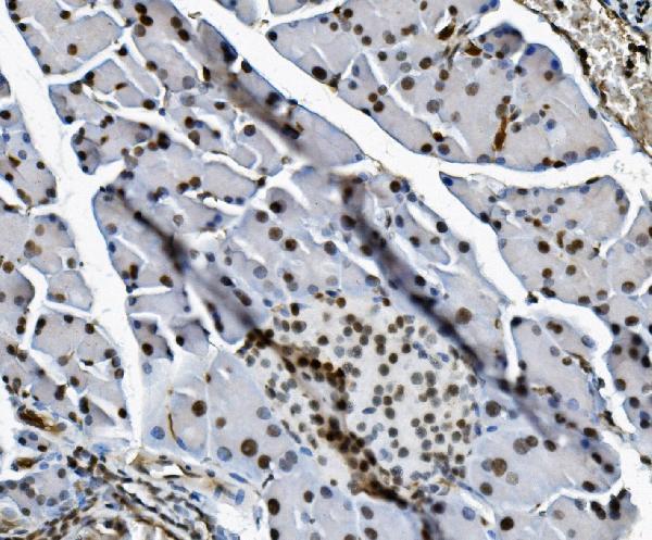 m02197 tkt primary antibodies ihc testing 2