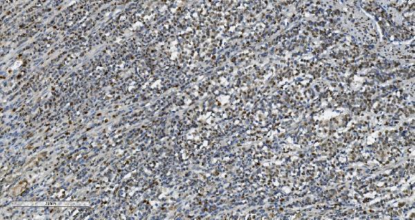 m02197 tkt primary antibodies ihc testing 4