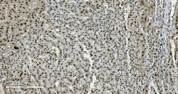 m02197 tkt primary antibodies ihc testing 5