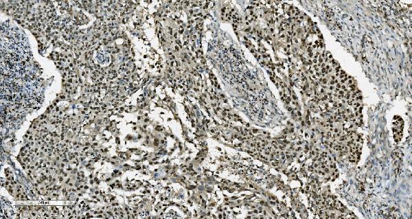m02197 tkt primary antibodies ihc testing 6