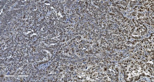 m02197 tkt primary antibodies ihc testing 7