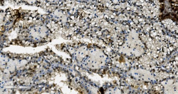 m02197 tkt primary antibodies ihc testing 8