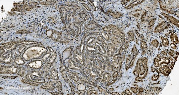 m02197 tkt primary antibodies ihc testing 9