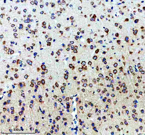 IHC analysis of G3BP using anti-G3BP antibody (M02199)