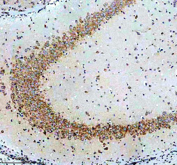 IHC analysis of G3BP using anti-G3BP antibody (M02199)