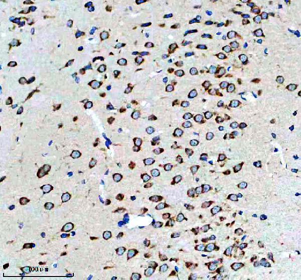 m02199 g3bp primary antibodies ihc testing 3