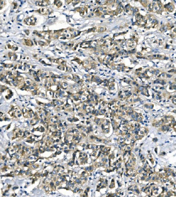  IHC analysis of ASS1 using anti-ASS1 antibody (M02212-1)
