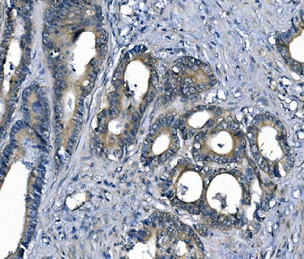 m02212 1 ass1 primary antibodies ihc testing 4