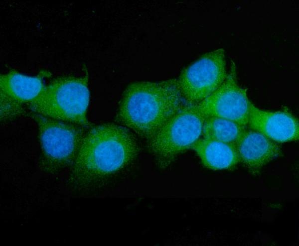 m02212 2 ass1 primary antibodies if testing 7