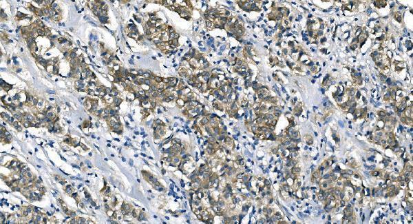  IHC analysis of ASS1 using anti-ASS1 antibody (M02212-2)