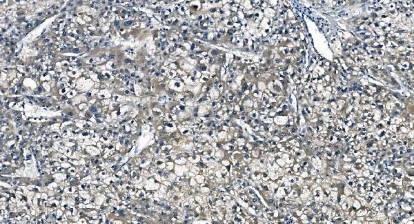  IHC analysis of ASS1 using anti-ASS1 antibody (M02212-2)