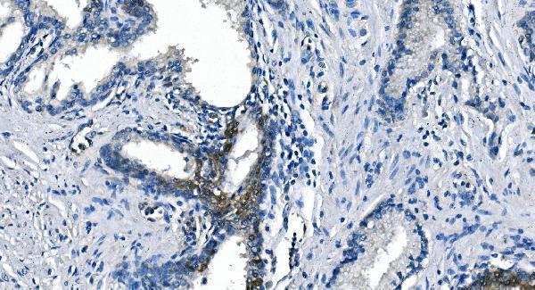 m02212 2 ass1 primary antibodies ihc testing 4