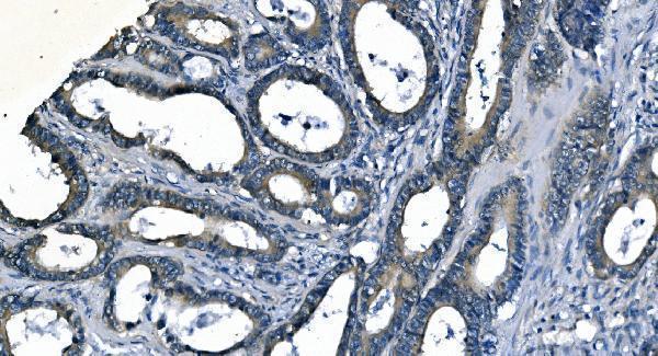 m02212 2 ass1 primary antibodies ihc testing 5