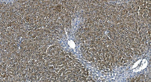 m02212 2 ass1 primary antibodies ihc testing 6