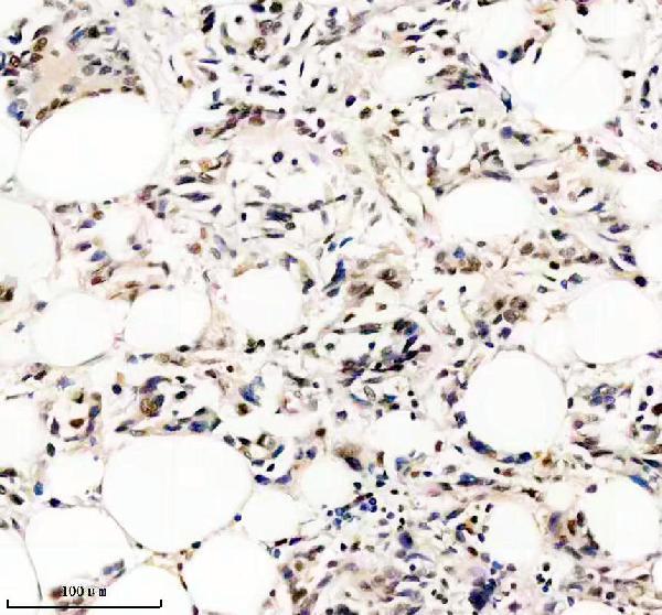 IHC analysis of RSK2/RPS6KA3 using anti-RSK2/RPS6KA3 antibody (M02215-1)
