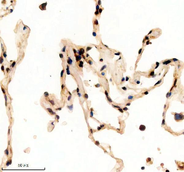 IHC analysis of RSK2/RPS6KA3 using anti-RSK2/RPS6KA3 antibody (M02215-1)
