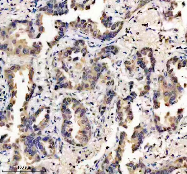 m02215 1 rps6ka3 primary antibodies ihc testing 3