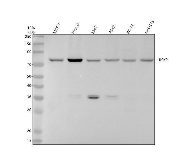 Western blot analysis of RSK2 using anti-RSK2 antibody (M02215-1)