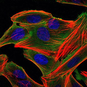 Immunofluorescence analysis of HepG2 cells using Rsk-2 Monoclonal Antibody (green)