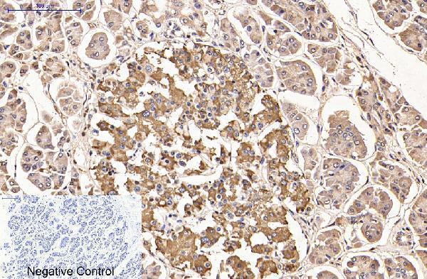 Immunohistochemistry validation of AMACR using Anti-Alpha-methylacyl-CoA racemase AMACR Monoclonal Antibody (M02217-2)
