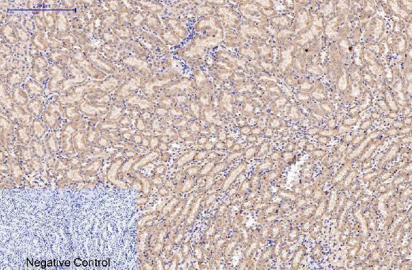 m02217 2 amacr primary antibodyes ihc testing 4