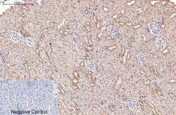 m02217 2 amacr primary antibodyes ihc testing 5