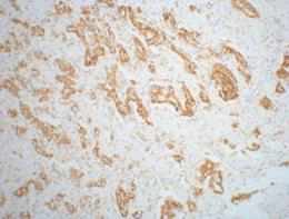 m02217 2 amacr primary antibodyes ihc testing 6