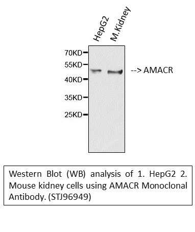 Western blotting validation for Anti-Alpha-methylacyl-CoA racemase AMACR Monoclonal Antibody M02217-2
Western blot (WB) analysis of AMACR monoclonal antibody