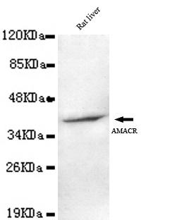 Western blot detection of AMACR (C-terminus) antibody in Rat Liver lysates using AMACR (C-terminus) antibody (1:1000 diluted) 