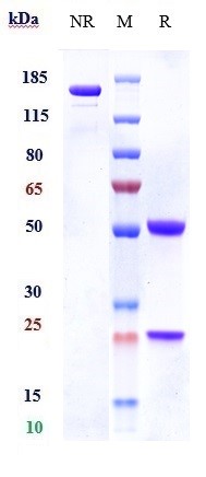 Anti-CSF2Rb/CD131 Reference Antibody (CSL311) on SDS-PAGE under reducing (R) condition