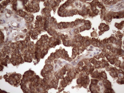 m02219 anti il3rb csf2rb mouse monoclonal antibody clone id oti4h3 ihc testing 2