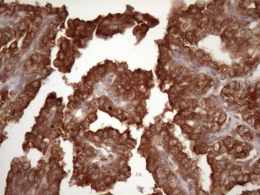 m02219 anti il3rb csf2rb mouse monoclonal antibody clone id oti4h3 ihc testing 3
