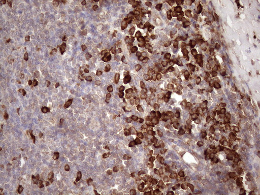 m02219 anti il3rb csf2rb mouse monoclonal antibody clone id oti4h3 ihc testing 4