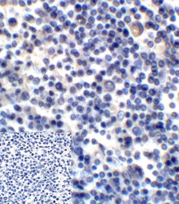 m02220 2 cd276 primary antibodies ihc testing 4